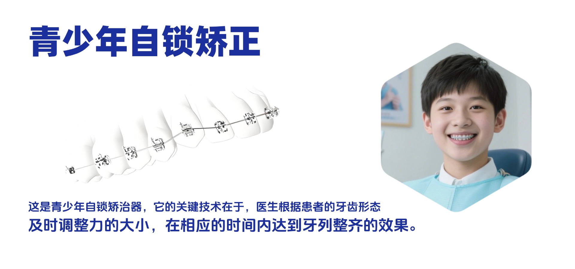 青少年自锁矫正