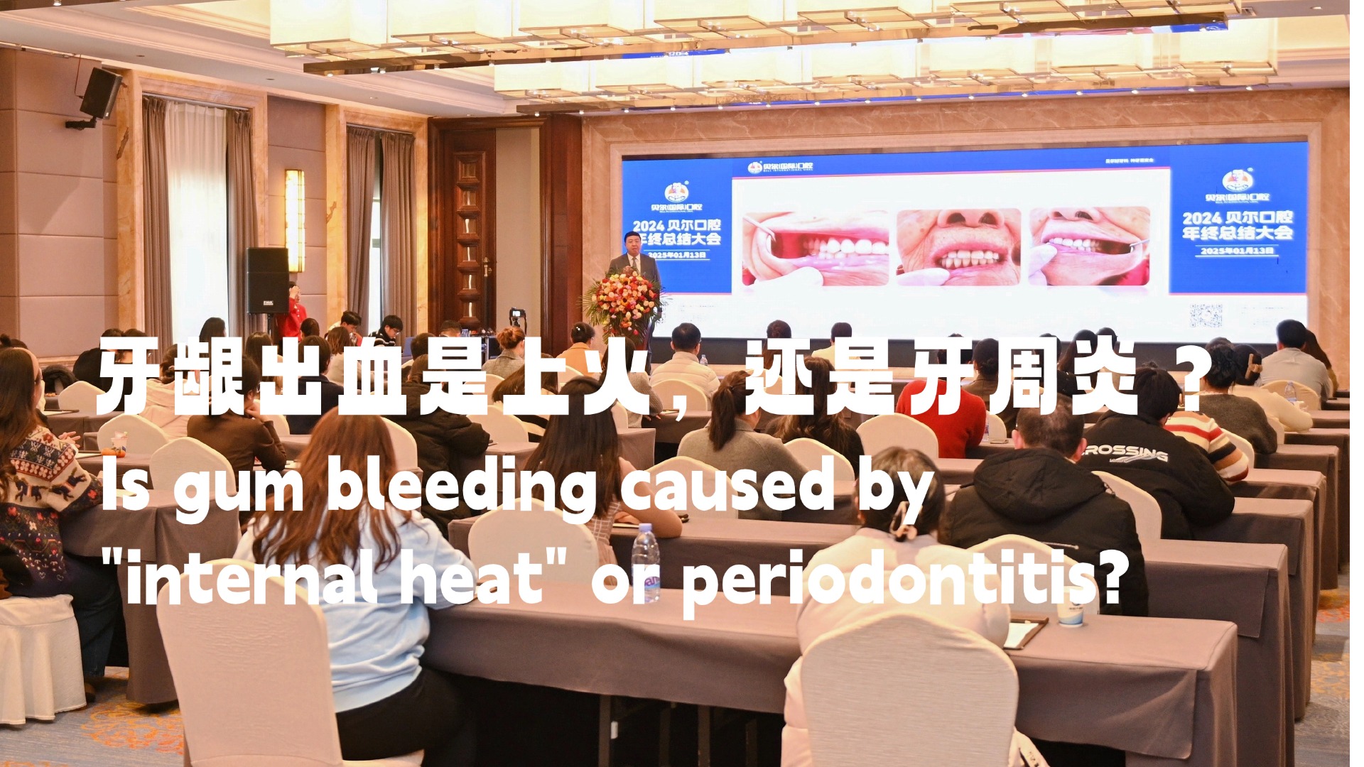 牙龈出血是上火，还是牙周炎？